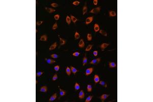 Immunofluorescence analysis of L929 cells using PPP1R9B antibody (ABIN7269681) at dilution of 1:100. (PPP1R9B Antikörper)