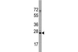 Western Blotting (WB) image for anti-CD9 (CD9) (AA 21-51) antibody (ABIN3030434)
