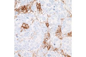 Immunohistochemistry (IHC) image for anti-CD40 (CD40) (AA 227-277) antibody (ABIN7454023) (Rekombinanter CD40 Antikörper  (AA 227-277))