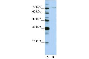 WB Suggested Anti-PRPF3 Antibody Titration:  0. (PRPF3 Antikörper  (N-Term))
