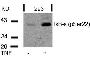 Western blot analysis of extracts from 293 cells untreated or treated with TNF using IkB-e(Phospho-Ser22) Antibody. (NFKBIE Antikörper  (pSer22))