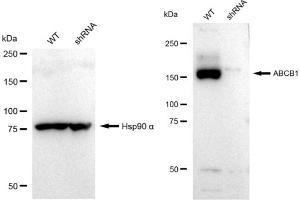 Western blotting analysis using ABCB1 antibody (ABIN7797683).