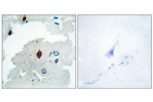 Immunohistochemistry (IHC) image for anti-Pituitary Tumor-Transforming 1 (PTTG1) (Internal Region) antibody (ABIN1849461) (PTTG1 Antikörper  (Internal Region))