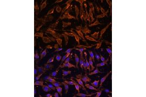 Immunofluorescence analysis of L929 cells using TNFRSF11A Polyclonal Antibody (ABIN6127588, ABIN6149309, ABIN6149311 and ABIN6216817) at dilution of 1:100 (40x lens). (TNFRSF11A Antikörper  (AA 466-616))