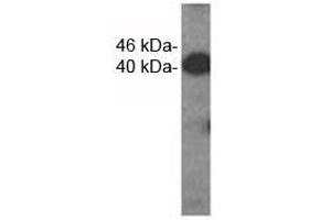 Western analysis of extracts from HDMEC cells using VEGFC antibody. (VEGFC Antikörper)