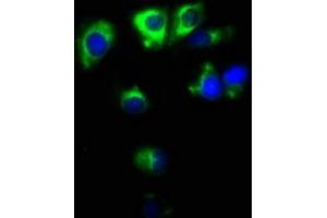 Immunofluorescence staining of MCF-7 cells with ABIN7171138 at 1:100, counter-stained with DAPI. (Synaptoporin Antikörper  (AA 199-265))