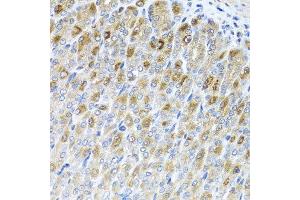 Immunohistochemistry of paraffin-embedded mouse stomach using MTX2 antibody at dilution of 1:100 (x40 lens). (MTX2 Antikörper)
