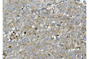 IHC analysis of ASAH1 using anti-ASAH1 antibody (ABIN7602206).