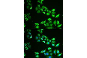 Immunofluorescence analysis of U2OS cells using CCBL1 antibody. (CCBL1 Antikörper  (AA 1-270))