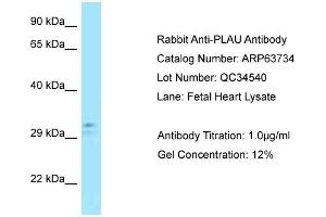 Western Blotting (WB) image for anti-Plasminogen Activator, Urokinase (PLAU) (C-Term) antibody (ABIN2789605) (PLAU Antikörper  (C-Term))