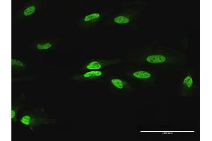 Immunofluorescence of purified MaxPab antibody to PAX2 on HeLa cell.