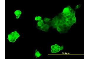 Immunofluorescence of monoclonal antibody to MYH9 on A-431 cell. (Myosin 9 Antikörper  (AA 131-220))