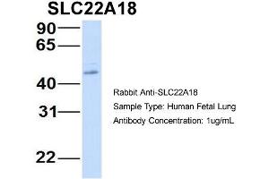 Host:  Rabbit  Target Name:  SLC22A18  Sample Type:  Human Fetal Lung  Antibody Dilution:  1. (ORCTL-2/SLC22A18 Antikörper  (N-Term))
