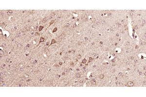 Paraformaldehyde-fixed, paraffin embedded mouse brain, Antigen retrieval by boiling in sodium citrate buffer (pH6) for 15min, Block endogenous peroxidase by 3% hydrogen peroxide for 30 minutes, Blocking buffer (normal goat serum) at 37°C for 20min, Antibody incubation with 14-3-3 beta Polyclonal Antibody, Unconjugated  at 1:400 overnight at 4°C, followed by a conjugated secondary and DAB staining. (YWHAB Antikörper  (AA 51-150))