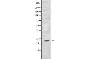 Western blot analysis of TAF10 using Jurkat whole cell lysates (TAF10 Antikörper  (N-Term))