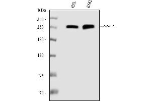 Western blot analysis of Ankyrin erythroid/ANK/ANK1 using anti-Ankyrin erythroid/ANK/ANK1 antibody (ABIN7599957).