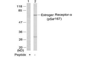 Image no. 3 for anti-Estrogen Receptor 1 (ESR1) (pSer167) antibody (ABIN196745) (Estrogen Receptor alpha Antikörper  (pSer167))