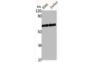 Western Blot analysis of K562 Jurkat cells using SNM1B Polyclonal Antibody