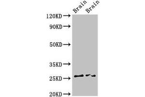 Western Blot Positive WB detected in: Rat brain tissue, Mouse brain tissue All lanes: FAM3B antibody at 3 μg/mL Secondary Goat polyclonal to rabbit IgG at 1/50000 dilution Predicted band size: 26, 31, 21 kDa Observed band size: 26 kDa (FAM3B Antikörper  (AA 31-235))