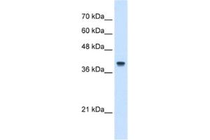 Western Blotting (WB) image for anti-Interferon-Induced Protein 44-Like (IFI44L) antibody (ABIN2462952) (IFI44L Antikörper)