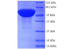 Ribosomal Protein L17 (RPL17) (AA 2-184), (full length) protein (GST tag)