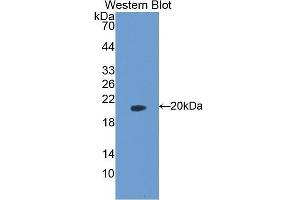 Western Blotting (WB) image for anti-Peptidylprolyl Cis/trans Isomerase, NIMA-Interacting 1 (PIN1) (AA 2-165) antibody (ABIN1078430)