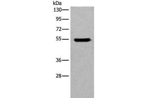 Western blot analysis of HEPG2 cell lysate using CYP11B2 Polyclonal Antibody at dilution of 1:650 (CYP11B2 Antikörper)
