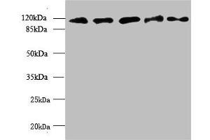 Western blot All lanes: MORC2 antibody at 6 μg/mL Lane 1: U87 whole cell lysate Lane 2: U251 whole cell lysate Lane 3: Jurkat whole cell lysate Lane 4: Hela whole cell lysate Lane 5: MCF-7 whole cell lysate Secondary Goat polyclonal to rabbit IgG at 1/10000 dilution Predicted band size: 118, 111 kDa Observed band size: 118 kDa (MORC2 Antikörper  (AA 2-300))