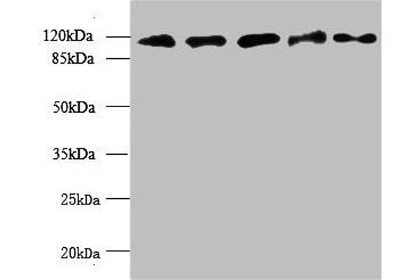 MORC2 antibody  (AA 2-300)