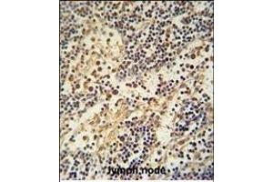 HEMK1 antibody (C-term) (ABIN654963 and ABIN2844602) immunohistochemistry analysis in formalin fixed and paraffin embedded human lymph node followed by peroxidase conjugation of the secondary antibody and DAB staining. (HEMK1 Antikörper  (C-Term))