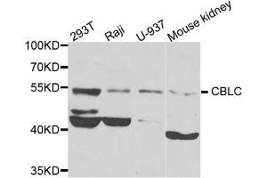 Western blot analysis of extracts of various cell lines, using CBLC antibody. (CBLC Antikörper  (AA 245-474))