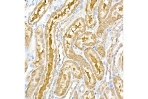 Immunohistochemistry of paraffin-embedded rat kidney using DENN Rabbit mAb (ABIN7268396) at dilution of 1:50 (40x lens). (MADD Antikörper)