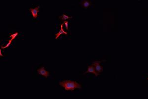 Immunofluorescence (fixed cells) (IF/ICC) image for anti-Aldo-Keto Reductase Family 1, Member C3 (3-alpha Hydroxysteroid Dehydrogenase, Type II) (AKR1C3) antibody (ABIN6259862)
