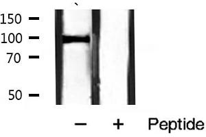 Western blot analysis of Catenin α1 expression in mouse muscle tissue lysates,The lane on the right is treated with the antigen-specific peptide. (CTNNA1 Antikörper  (C-Term))