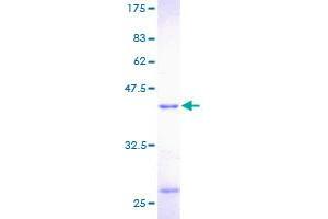 Image no. 1 for Profilin 1 (PFN1) (AA 1-140) protein (GST tag) (ABIN1314757)