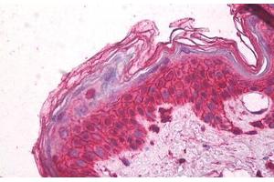Image no. 1 for anti-Chemokine (C-C Motif) Receptor 3 (CCR3) (AA 5-28) antibody (ABIN1495440) (CCR3 Antikörper  (AA 5-28))