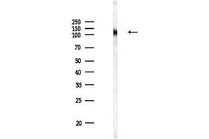 anti-Calpastatin (CAST) antibody