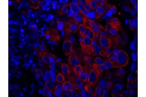 Immunofluorescence (IF) image for anti-SAM and SH3 Domain Containing 1 (SASH1) (AA 750-800) antibody (ABIN7449021)