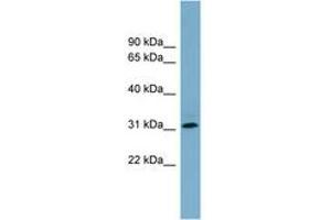 Image no. 1 for anti-Ring Finger Protein 144B (RNF144B) (AA 215-264) antibody (ABIN6743180) (RNF144B Antikörper  (AA 215-264))