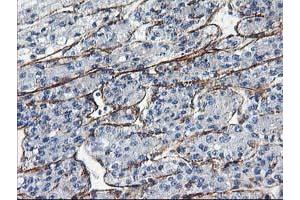 Image no. 1 for anti-Low Density Lipoprotein Receptor Adaptor Protein 1 (LDLRAP1) antibody (ABIN1496691) (LDLRAP1 Antikörper)