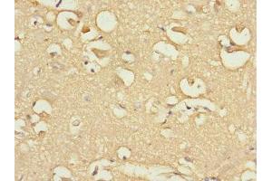 Immunohistochemistry of paraffin-embedded human brain tissue using ABIN7152437 at dilution of 1:100 (FBXO4 Antikörper  (AA 138-387))
