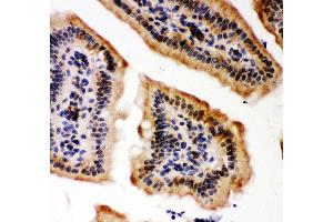 Immunohistochemistry (IHC) image for anti-E1A Binding Protein P300 (EP300) (AA 2065-2414) antibody (ABIN3042372)