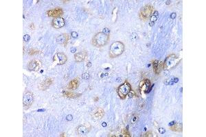 Immunohistochemistry (Paraffin-embedded Sections) (IHC (p)) image for anti-Ribosomal Protein S3A (RPS3A) antibody (ABIN7261840)