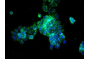 Immunofluorescence (Cultured Cells) (IF (cc)) image for anti-Cathepsin L1 (CTSL1) (AA 71-170) antibody (ABIN687532)