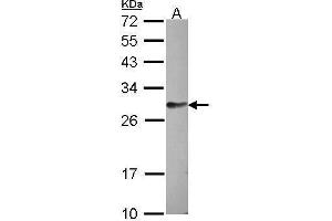 WB Image Sample (30 ug of whole cell lysate) A: HCT116 12% SDS PAGE antibody diluted at 1:1000 (FAM122B Antikörper)
