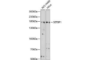 Western blot analysis of extracts of various cell lines, using SETBP1 antibody (ABIN6132919, ABIN6147635, ABIN6147636 and ABIN6223042) at 1:1000 dilution. (SETBP1 Antikörper  (AA 1-242))