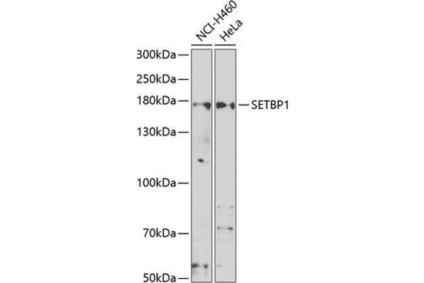 SETBP1 Antikörper  (AA 1-242)