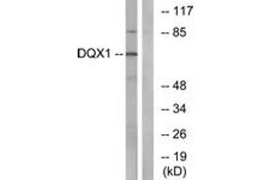 Western blot analysis of extracts from COS7 cells, using DQX1 Antibody. (DQX1 Antikörper  (AA 551-600))