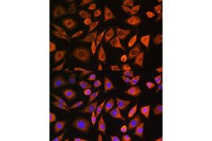 Immunofluorescence analysis of L929 cells using CNOT1 Rabbit pAb (ABIN6127561, ABIN6138777, ABIN6138778 and ABIN6221649) at dilution of 1:100. (CNOT1 Antikörper  (AA 2137-2376))