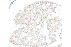 Immunohistochemistry (IHC) image for anti-Cyclin-Dependent Kinase 1 (CDK1) (AA 1-50) antibody (ABIN7454007)